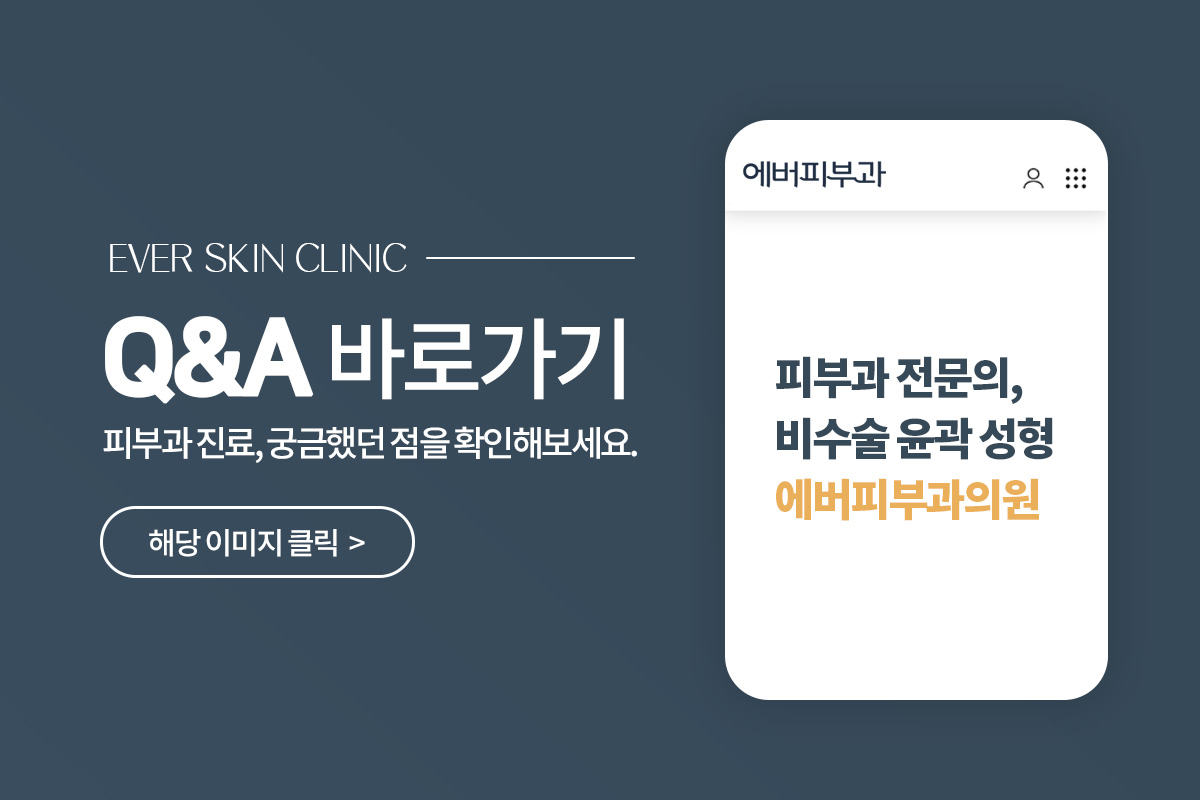 Q&A
