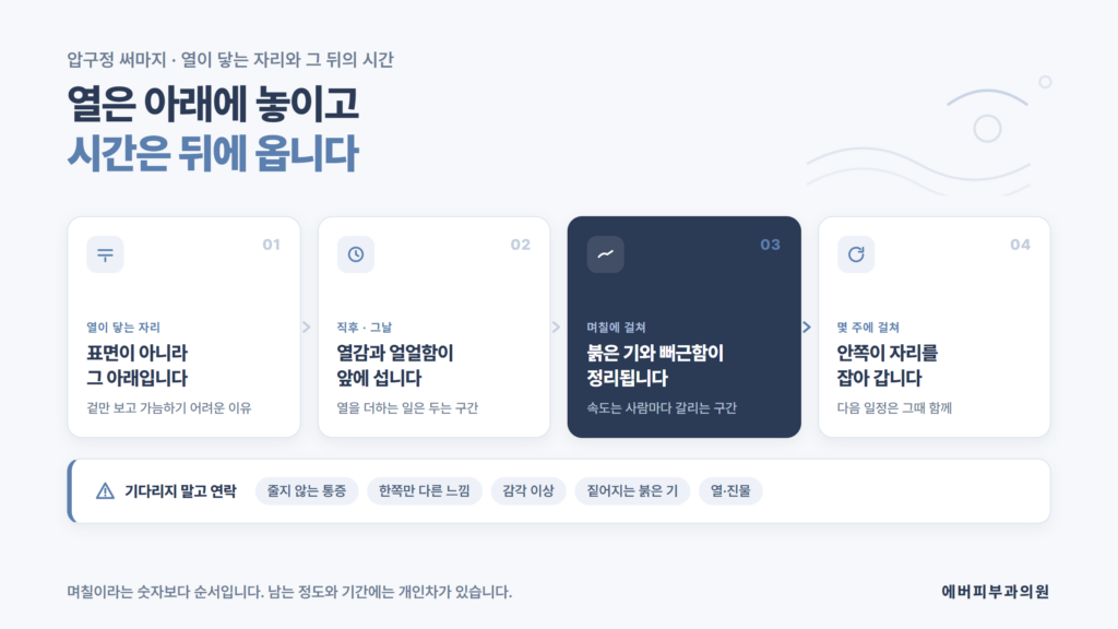 써마지의 열이 닿는 자리와 시술 직후부터 몇 주에 걸친 회복 순서를 정리한 에버피부과의원 자료 이미지